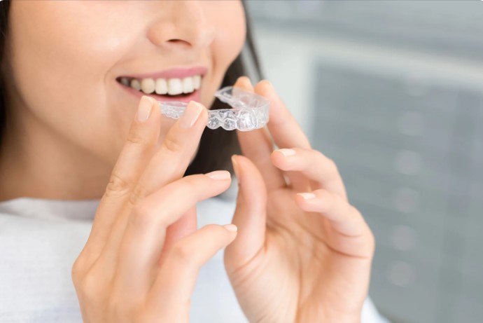 дешевле брекеты или каппы